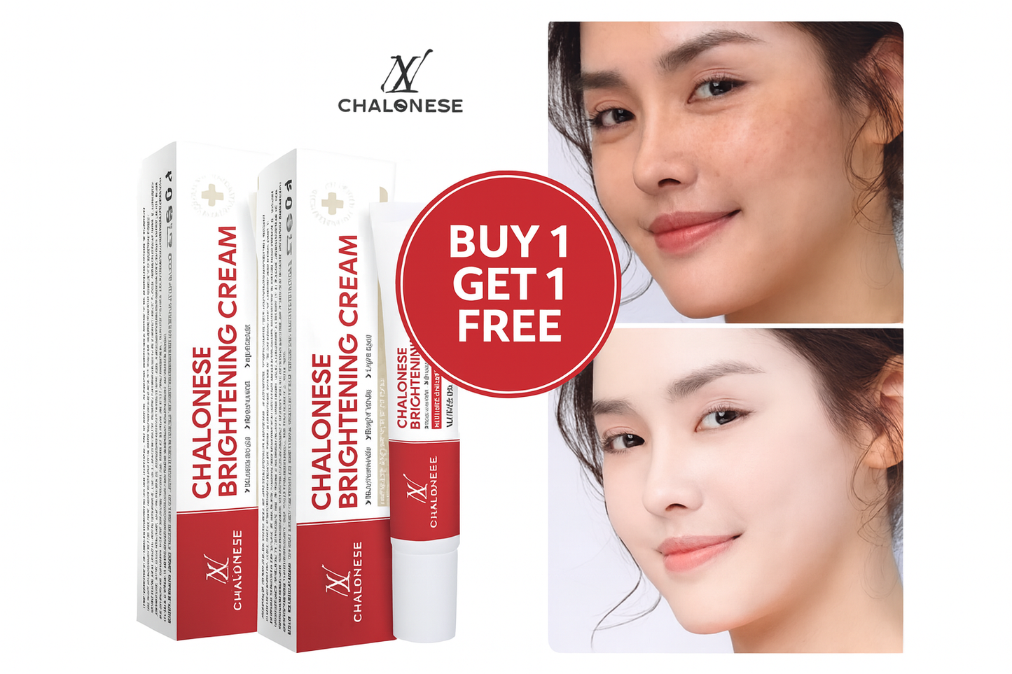 Chalonese Brightening Cream – Buy 1 Get 1 Free